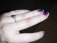 Bite-Knuckle.JPG
