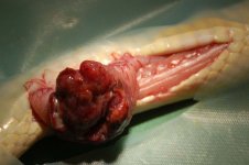 tumor sectie inet.jpg