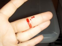 Bite-Blood.JPG