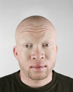 Albino.jpg