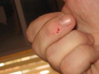 housebite1.JPG