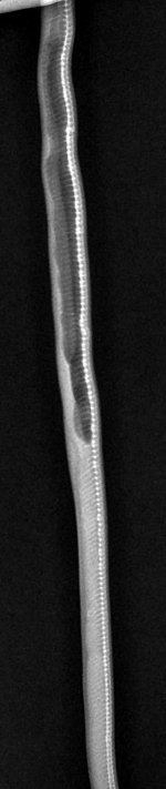 latero-lateral.jpg