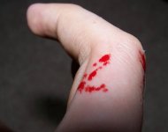 bite.jpg