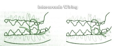 Interarcade Wiring.jpg