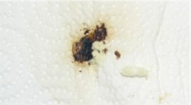 fecal.jpg