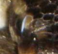 bad eye.jpg