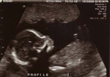 18-wk ultrasound -- profile.jpg