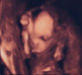 18-wk 4d ultrasound.jpg