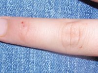 2009-08-24 AneryMotBite_Edit.jpg