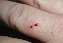 Bite Clubcr.jpg