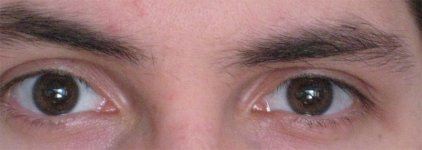Eyes.jpg Eyes.jpg