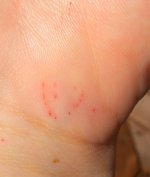 002sirona bite.jpg