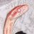 temporalis